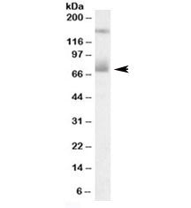 Western blot testing of human placenta lysate with Mesothelin antibody at 0.3ug/ml. The expected ~70
