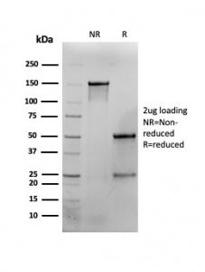 SDS-PAGE analysis of purified, BSA-free Interferon gamma antibody (clone G-23) as confirmation of in