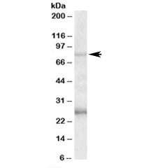 Western blot testing of human hippocampus lysate with GPRIN3 antibody at 1ug/ml. The expected ~80kDa