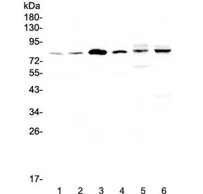 Western blot testing of human 1) HeLa, 2) COLO-320, 3) SK-O-V3, 4) Jurkat, 5) rat heart and 6) mouse