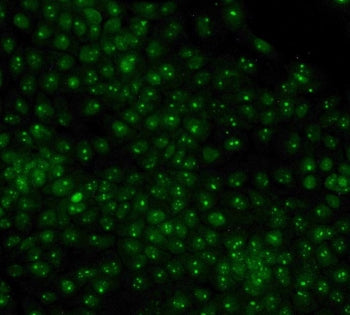 Nucleophosmin Antibody (NPM1)