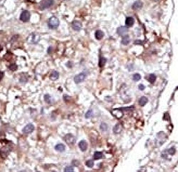 SPHK2 Antibody
