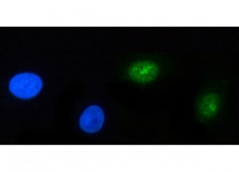 POLR3GL Antibody / RPC32 beta