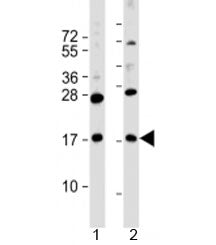 Western blot testing of human 1) MKN45 and 2) PANC-1 cell lysate with FAM159B antibody at 1:2000. Pr