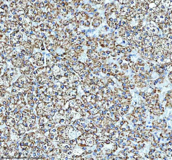 Immunohistochemical staining of GLUD1 using anti-GLUD1 antibody. GLUD1 was detected in a paraffin-em