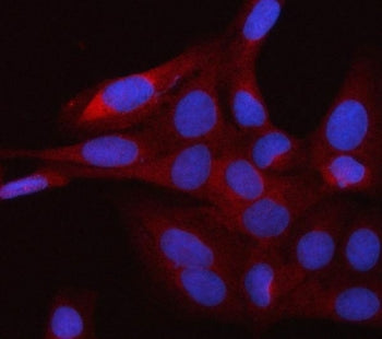 smgGDS Antibody / RAP1GDS1