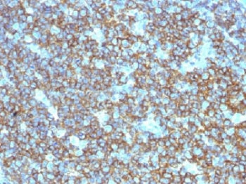 CD20 Antibody