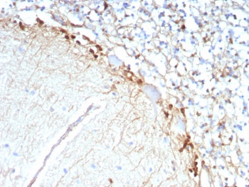 IHC staining of FFPE human brain tissue with recombinant GLUL antibody (clone rGLUL/8620). HIER: boi