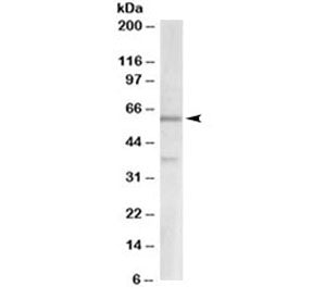 Western blot testing of human cerebellum lysate with VGLUT2 antibody at 2ug/ml. Molecular weight: th