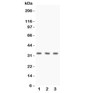 Western blot testing of Calponin antibody and human 1) HeLa, 2) Jurkat, and 3) MCF7 cell lysate. Exp