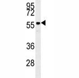 AKT2 Antibody, 0.4ml