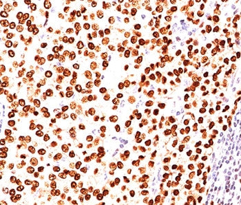 Progesterone Receptor Antibody