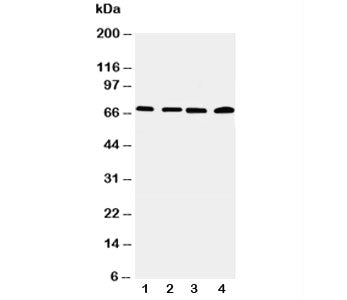 Western blot testing of IRAK2 antibody and Lane 1: 22RV; 2: A549; 3: PANC; 4: SMMC-7721 cell lysate