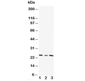 Western blot testing of TIMP4 antibody and Lane 1: HT1080; 2: HeLa; 3: SMMC-7721 cell lysate. Predic
