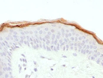 IHC testing of FFPE human skin with Filaggrin antibody (clone FLG1-1). Required HIER: boil tissue se