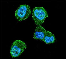 Confocal immunofluorescent analysis of LKB1 antibody with ZR-75-1 cells followed by Alexa Fluor 488-