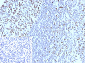 MCM3 Antibody