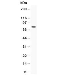 Western blot testing of hCG receptor antibody and MCF-7 lysate. Predicted/observed molecular weight: