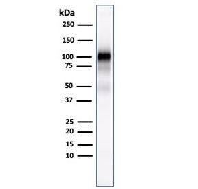 Western blot testing of human pancreas lysate with GP2 antibody (clone GP2/1803).