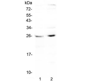 Western blot testing of human 1) HepG2 and 2) PANC-1 cell lysate with CTR1 antibody at 0.5ug/ml. Exp
