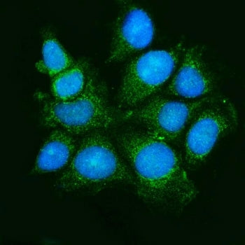 Apoptosis Signal-regulating Kinase 1 Antibody / ASK1 / MAP3K5