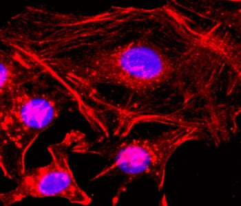 ICC staining of human HeLa cells using the recombinant Beta Actin antibody at 1:200 (red) and DAPI t
