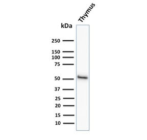 Western blot testing of human thymus tissue lysate with Keratin 15 antibody (clone KRT15/2958). Expe