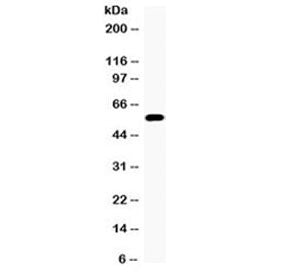 Western blot testing of 22RV1 cell lysate (prostate carcinoma) with CYP17A1 antibody at 0.5ug/ml. Pr