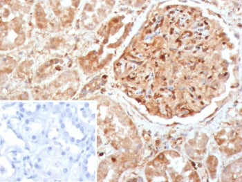 IHC staining of FFPE human kidney tissue with CASP7 antibody (clone CASP7/9054). Inset: PBS used in 