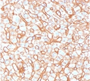 IHC staining of FFPE human liver tissue with APOB antibody (clone APOB/4332). HIER: boil tissue sect