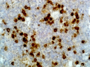 IHC testing of FFPE human tonsil tissue with recombinant Human Lambda Light Chain antibody. A pH6 Ci