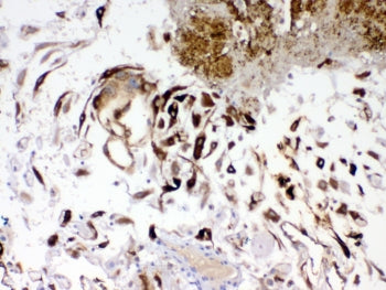 IGFBP1 Antibody