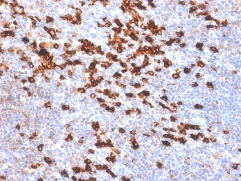 IHC testing of FFPE human tonsil tissue with recombinant anti-Kappa antibody (clone IGKC/1999R). Req