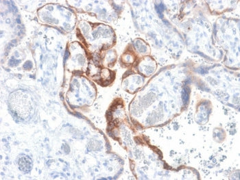 IHC testing of FFPE human placenta with HCG-beta antibody (clone HCGb/1985R). Required HIER: boil ti