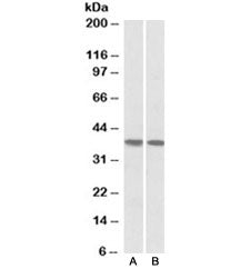 Western blot testing of human heart [A] and lung [B] lysates with KLF2 antibody at 1ug/ml. Predicted