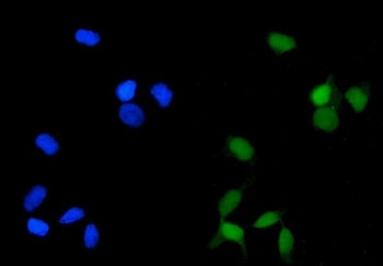 PPP2CA Antibody / PP2A alpha