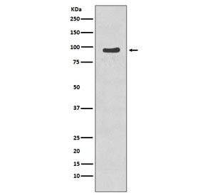 Western blot testing of etoposide-treated human Jurkat cell lysate with phospho-NBS1 antibody. Predi
