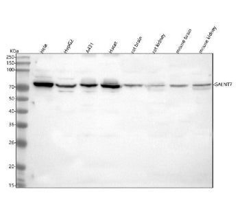 Western blot analysis of GALNT7 using anti-GALNT7 antibody. Lane 1: human Hela whole cell lysates, L