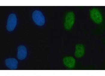 ZMYM2 Antibody / Zinc finger MYM-type protein 2