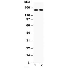 Western blot testing of Topoisomerase II alpha antibody and human 1: HeLa; 2: Jurkat cell lysate; Pr