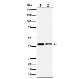 Western blot testing of 1) human Jurkat and 2) mouse RAW264.7 cell lysate with STOML2 antibody. Pred