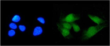 Immunofluorescent staining of FFPE human U-2 OS cells with SS-A antibody (green) and DAPI nuclear st