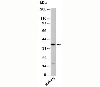 Western blot testing of human samples with GBL antibody at 1ug/ml.