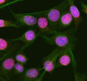 Immunofluorescent staining of RGL3 using anti-RGL3 antibody (red) and anti-Beta Tubulin antibody (gr