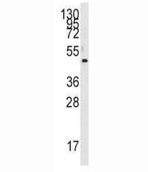 Western blot analysis of PDK4 antibody and HL-60 lysate. Predicted molecular weight ~46 kDa.