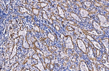 IHC staining of FFPE human splenic rupture tissue with NLRP7 antibody. HIER: boil tissue sections in