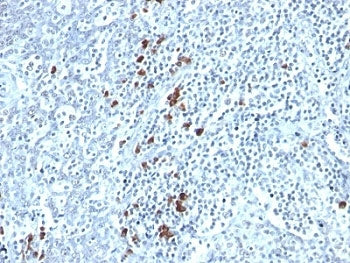 Kappa Light Chain Antibody