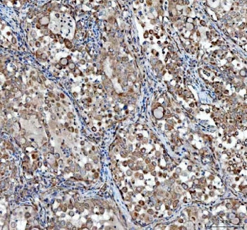 VEGFA Antibody