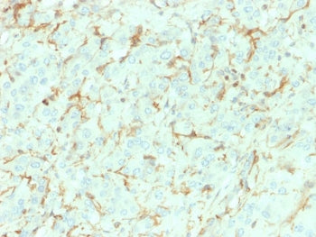IHC testing of FFPE human adrenal gland with NGF Receptor antibody (clone NGFR/1964). HIER: boil tis
