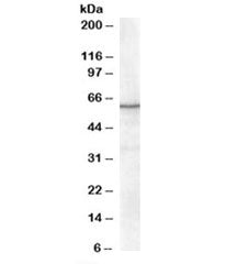 Western blot testing of nuclear HeLa lysate with RXR alpha antibody at 0.3ug/ml. Predicted molecular